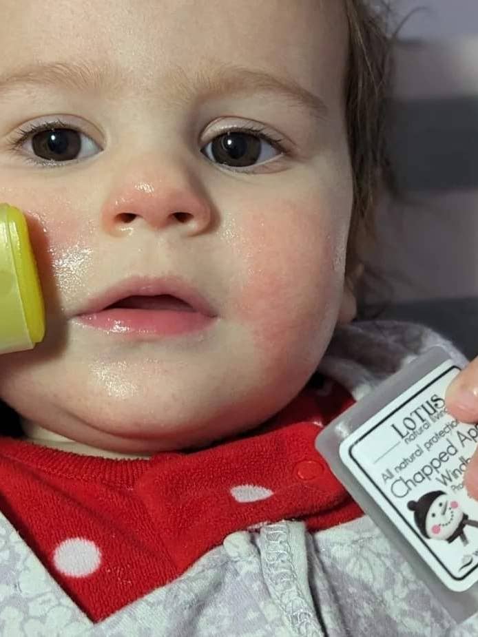 Chapped Apples for wholesale by Lotus Natural Living