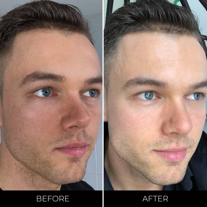 BETTR - Vendita all'ingrosso Kit per la cura del viso - Better You Set: il set completo per la cura della pelle™12