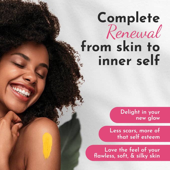 Complete Renewal LLC – wholesale Scar cream – Scar Butter with Turmeric and Aloe Vera- Scar Eraser Scar Cr8