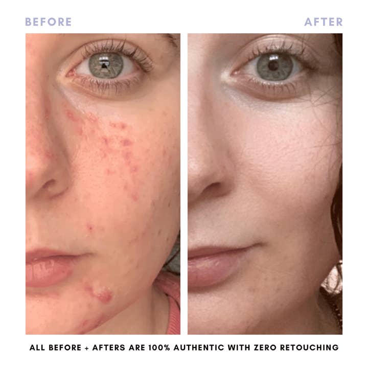 Clover By Clove + Hallow – Großhandel Gesichtspflege-Set – Das Juicy Skin Set4