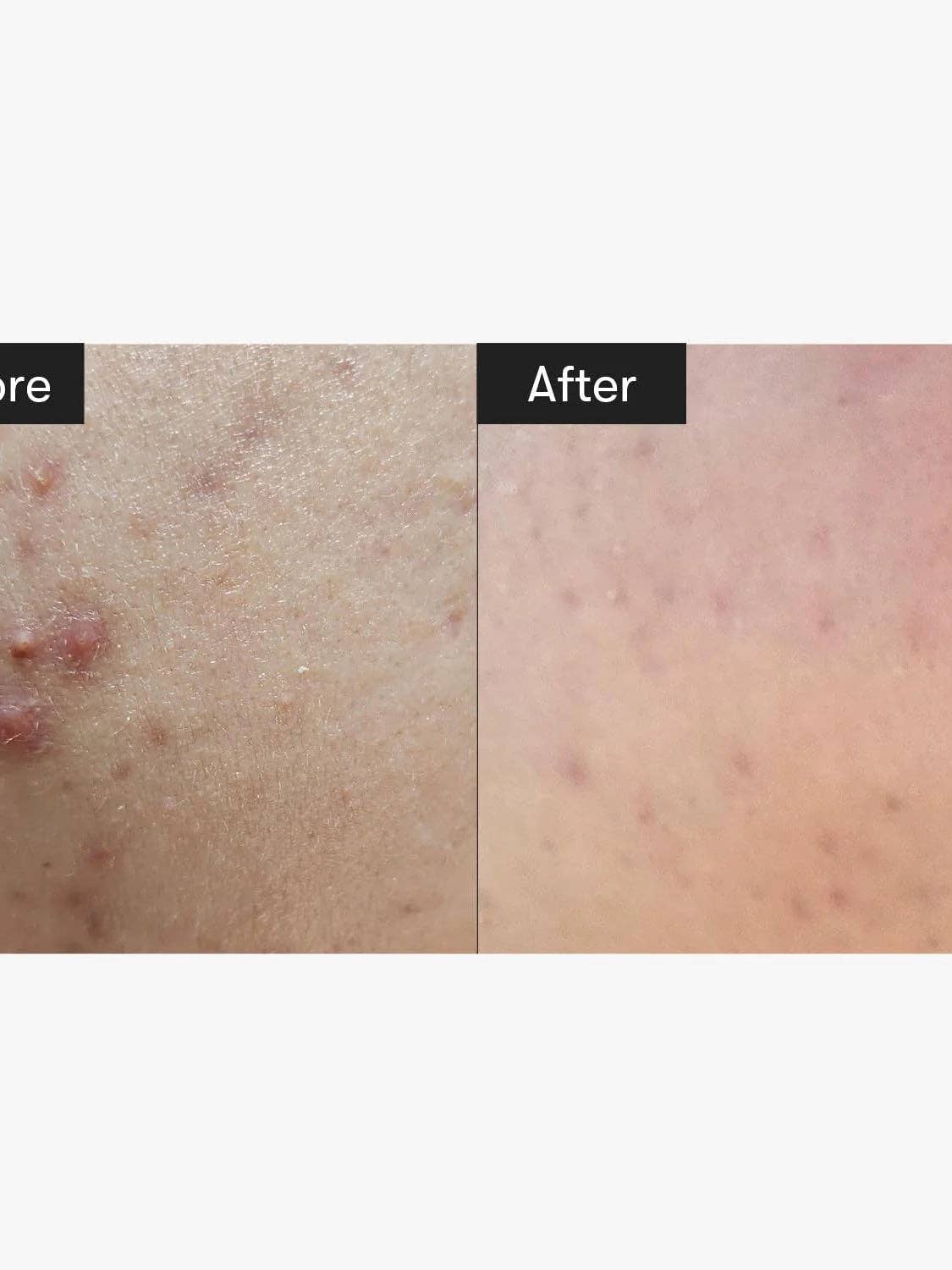 Sol Beauty Lab - Wholesale Facial Serum/Concentrate - VT COSMETICS CICA Reedle Shot 3003