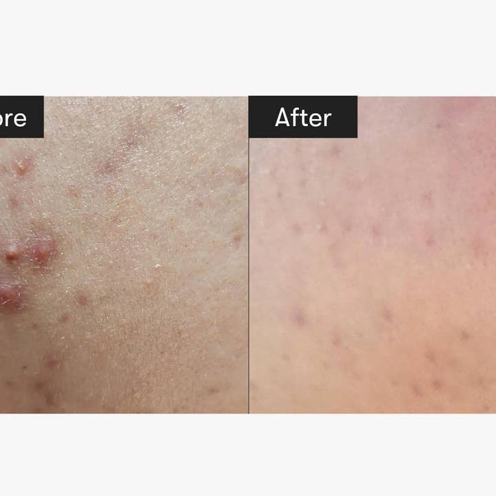 Sol Beauty Lab - Wholesale Facial Serum/Concentrate - VT COSMETICS CICA Reedle Shot 3003