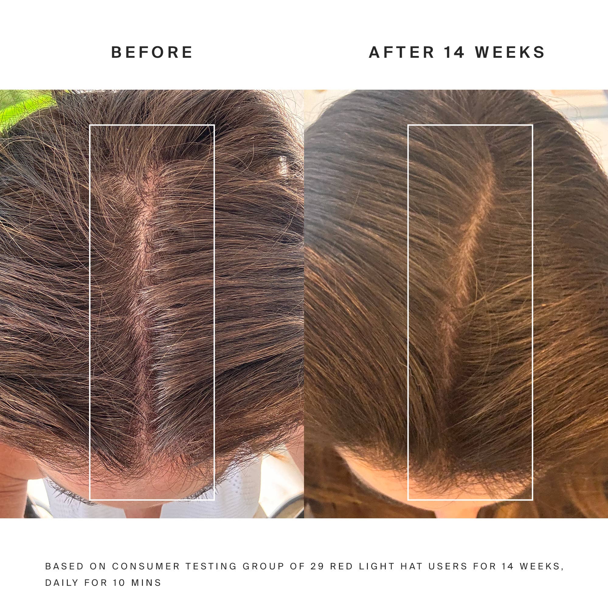 HigherDOSE - Vente Casquette de baseball – unisexe - Chapeau à lumière rouge HigherDose8