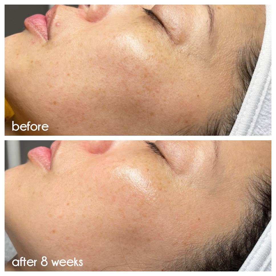 >beauty - Wholesale Facial Serum/Concentrate - Clean Slate Serum5