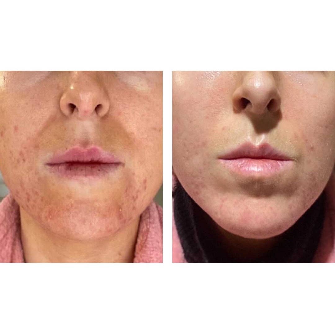 Koko and Kush – wholesale Ansiktsserum/-koncentrat – Serum - Bong Appetit6