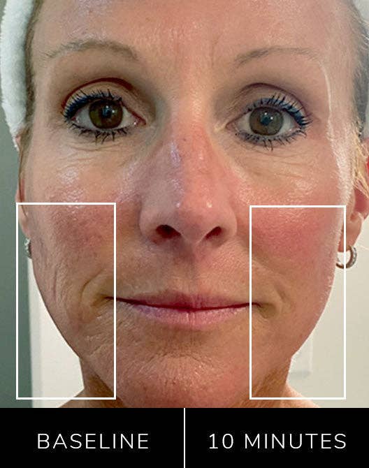 Nature Checkout Inc - Wholesale Electronic Skincare Device - Eno Patented All-In-One Skincare Device. The one device that does it all - exfoliation;  product infusion & facial sculpting13