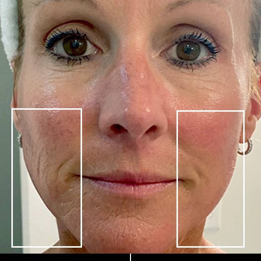 Nature Checkout Inc - Wholesale Electronic Skincare Device - Eno Patented All-In-One Skincare Device. The one device that does it all - exfoliation; product infusion & facial sculpting13