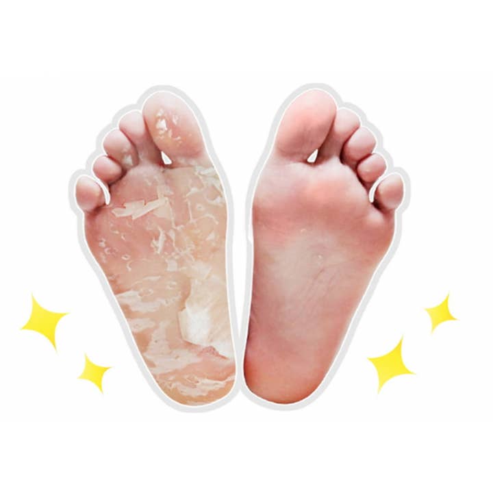 Callas & Dearderm – wholesale Foot mask – DEARDERM PYT FOOT PEELING ESSENCE MASK