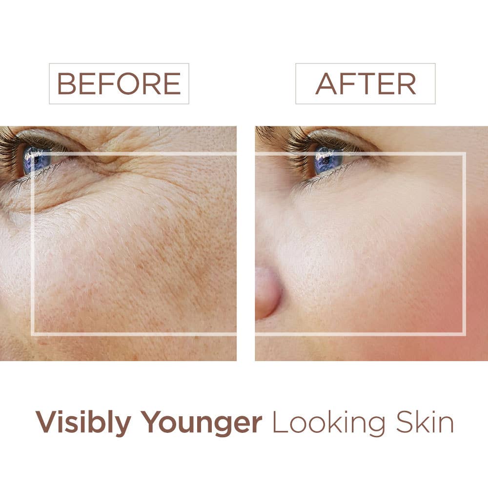 BEE&YOU – Großhandel Gesichtsserum/-konzentrat – Anti-Aging-Gesichtsserum mit Bienengift und Hyaluronsäure4