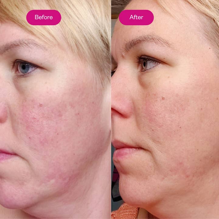 Flow Cosmetics - Wholesale Facial Serum/Concentrate - AHA & BHA Peeling Serum2