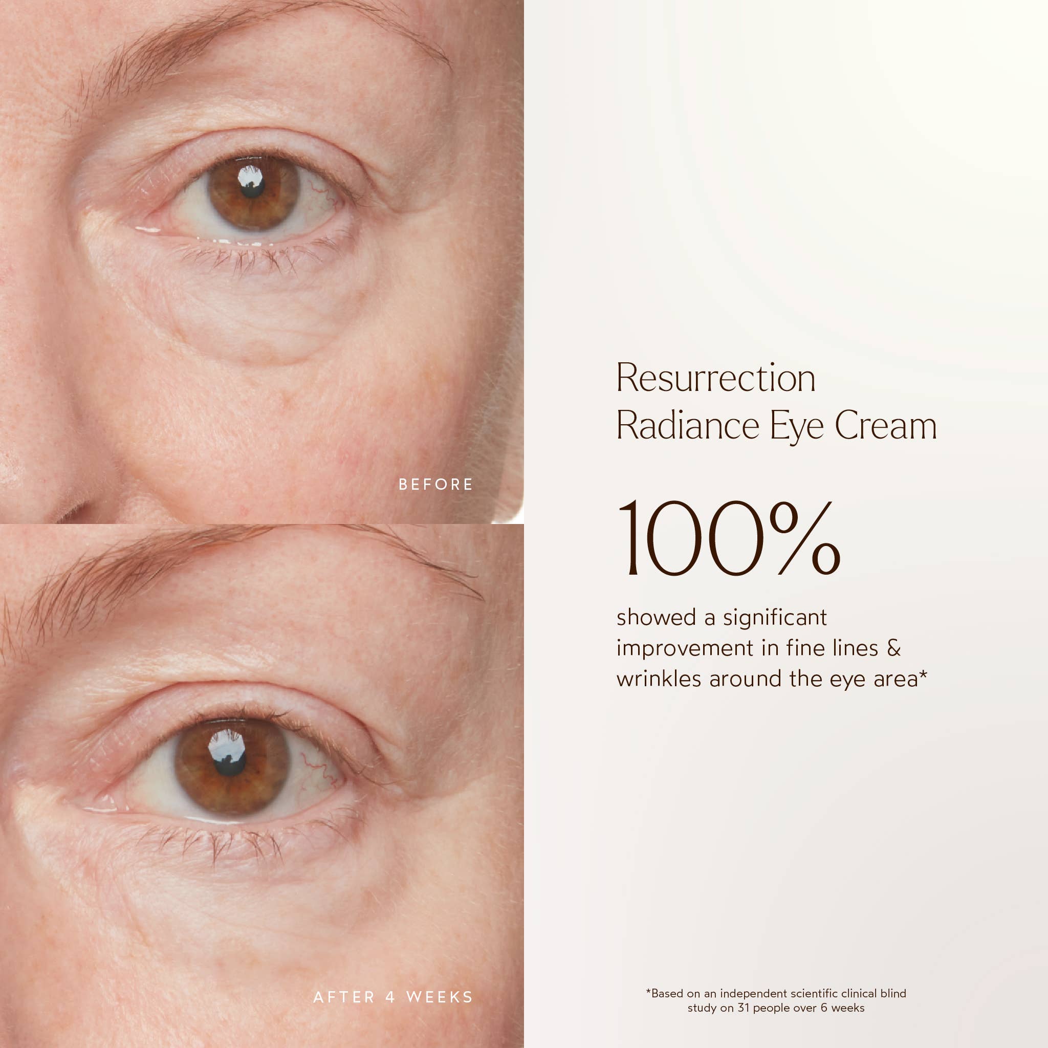 True Botanicals - Wholesale Eye Cream/Gel - Renew Resurrection Radiance Eye Cream3