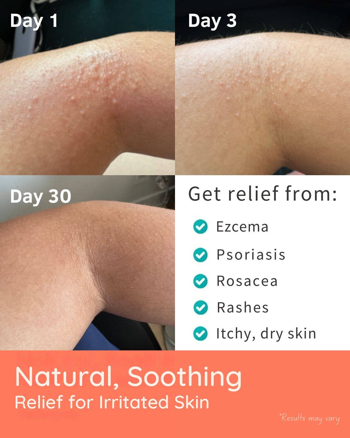 YoRo Naturals - Wholesale Hand & Body Lotion - Natural Manuka Honey Balm for Eczema, Sensitive and Dry Skin1