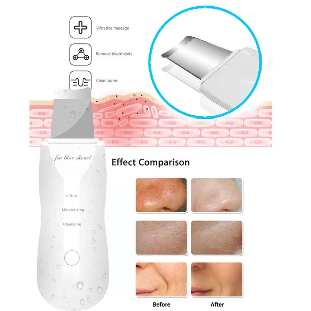 Assorted Ultrasonic Skin Scrubber Deep Face Cleaning Tool for wholesale on Faire2