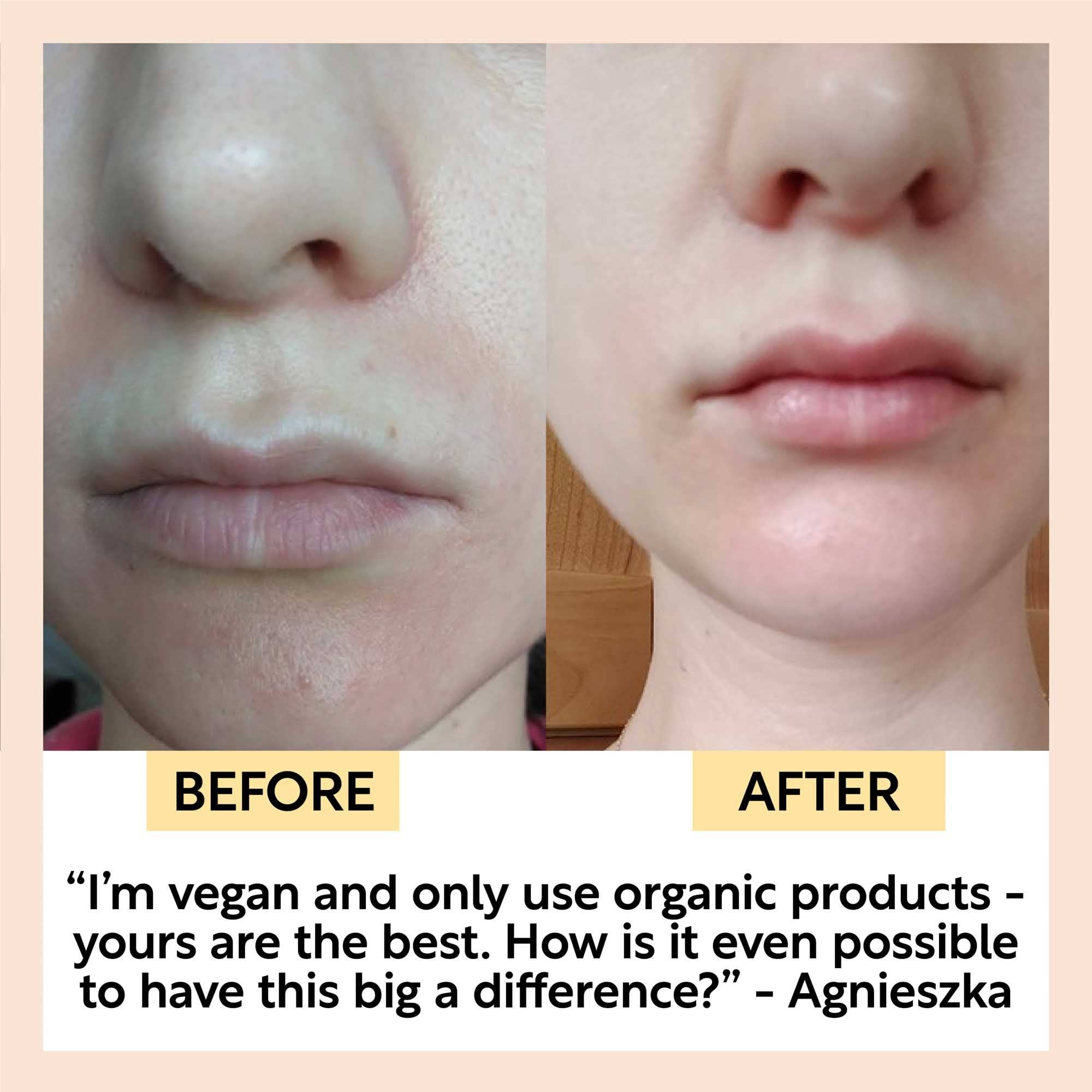 VIAI Beauty – wholesale Facial oil – Hydrating Face Oil with Coffee Extract8