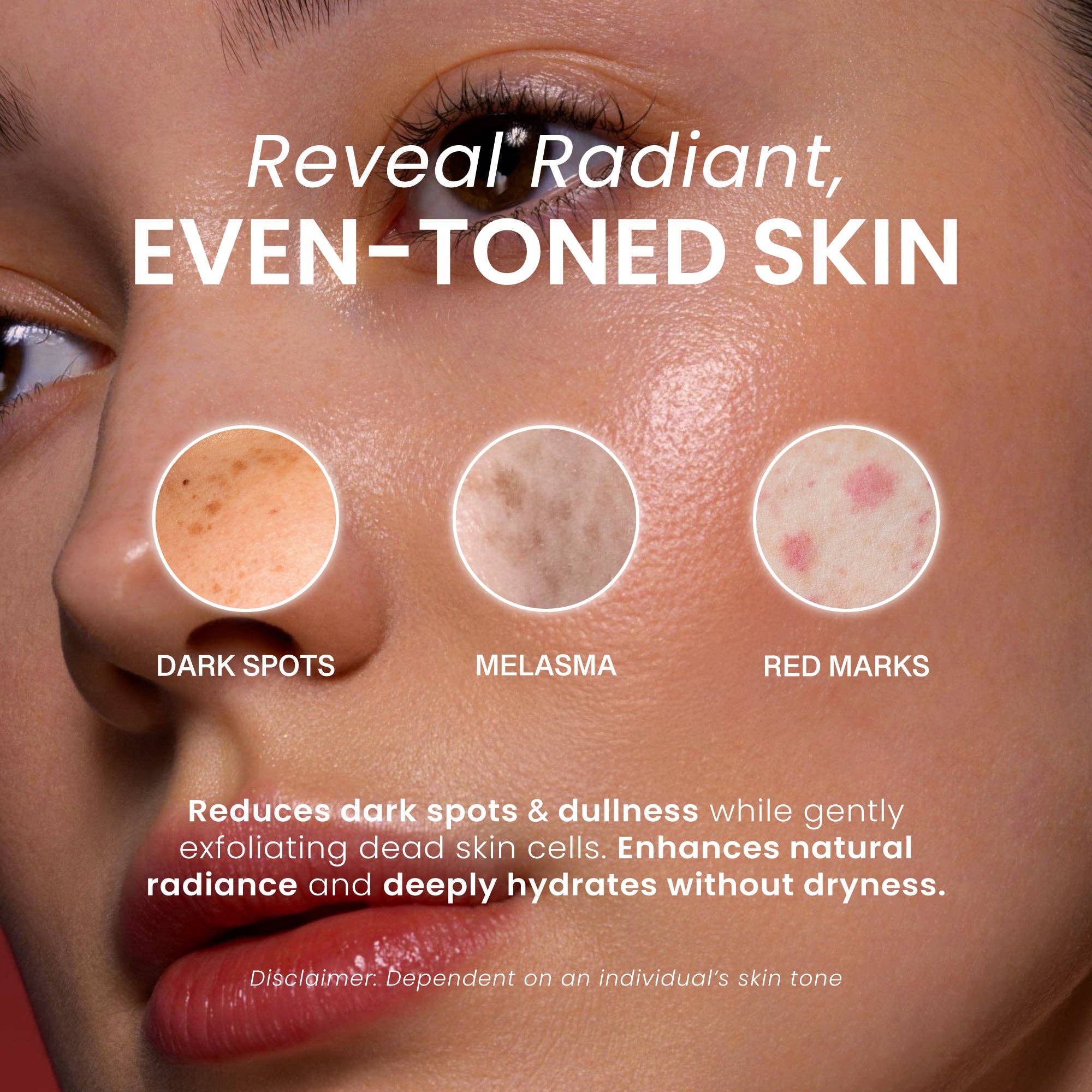 Koji White - Wholesale Bar Soap - Pure 5% Kojic Acid Skin Brightening Soap (2 Bars)3