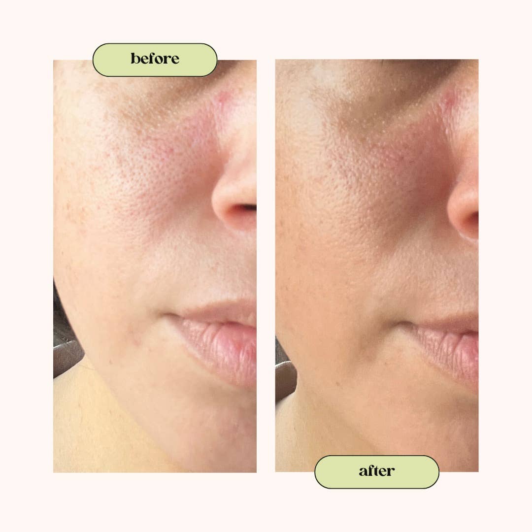 Dahlia Skincare - Wholesale Facial Moisturizer - Blueberry & Matcha Facial Moisturizer3