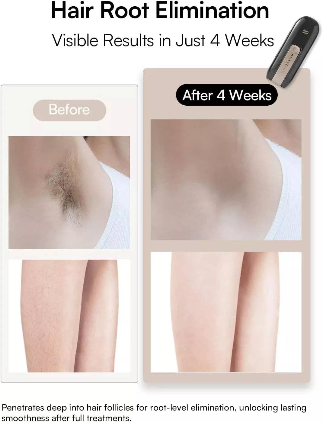 My Wholesale Warehouse - Wholesale Electronic Skincare Device - INIA Laser Hair Removal Device1