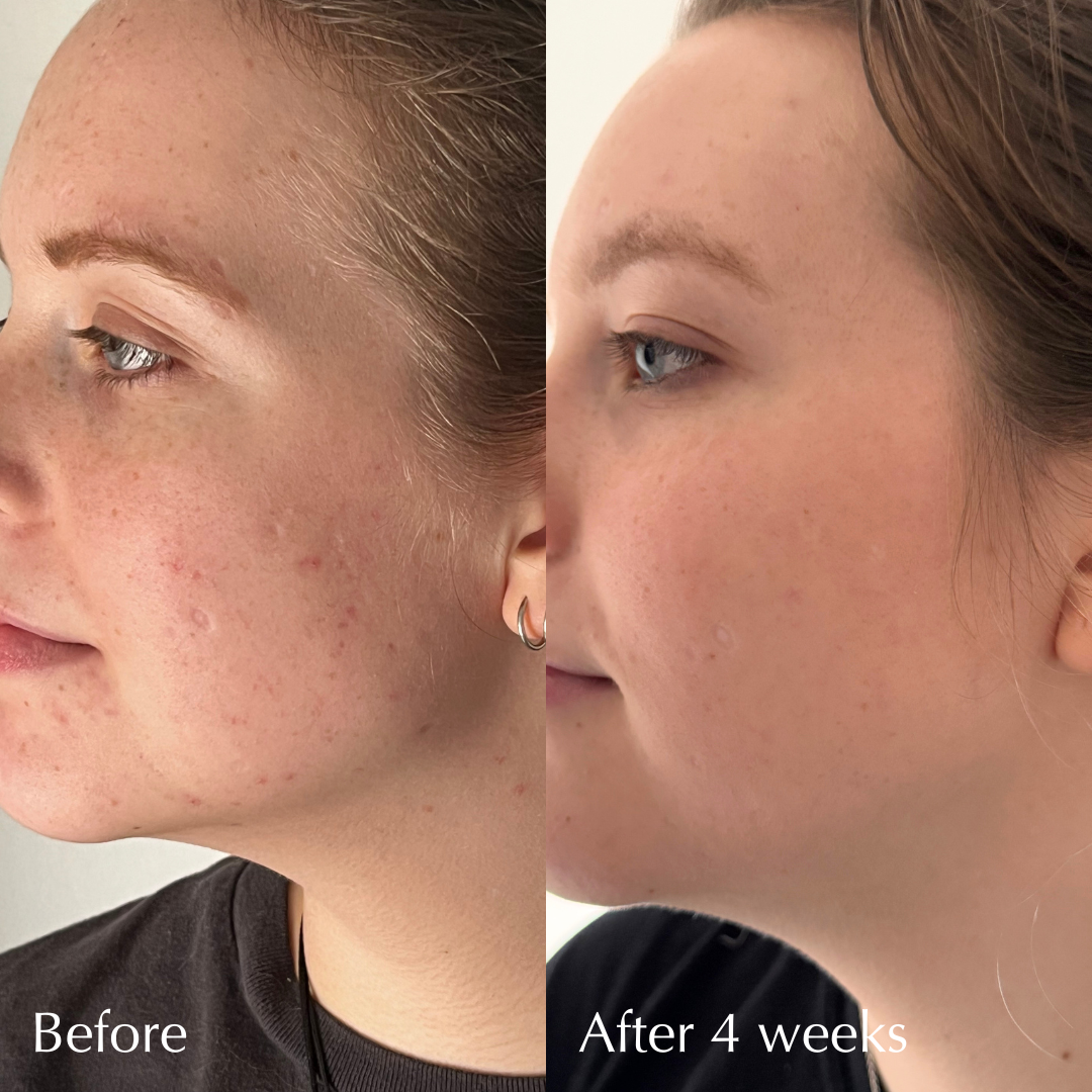 IN YOUR FACE SKINCARE - Wholesale Facial Serum/Concentrate - BIO PEPTIDE EGF-6 FIRMING SERUM2