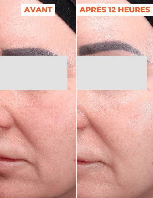 DERMEDEN - Vente Masque exfoliant pour le visage - Peeling avancé en 2 étapes inspiré de techniques dermatologiques6