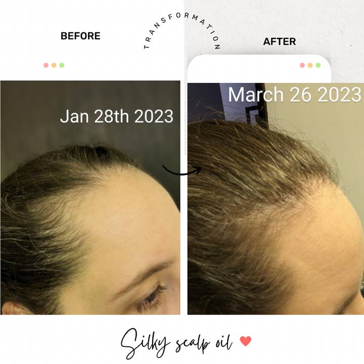 Sutton Michelle Designs - Wholesale Hair Oil - Growth Scalp Oil12