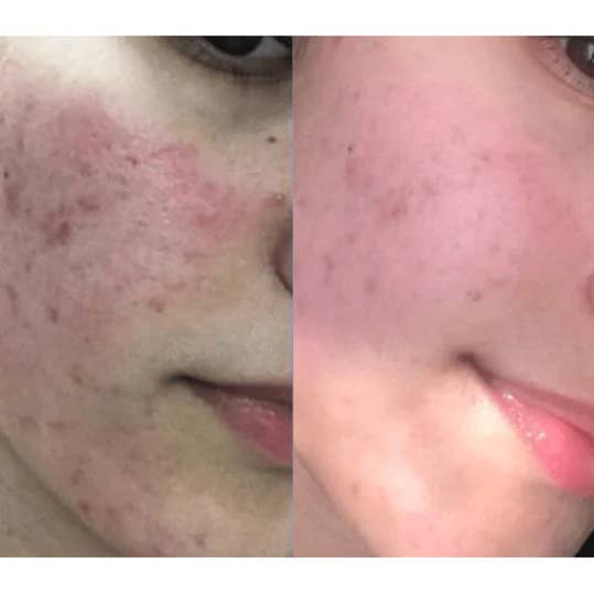 DERMEDEN - Wholesale Facial Moisturizer - Cicaderm Repair Care2