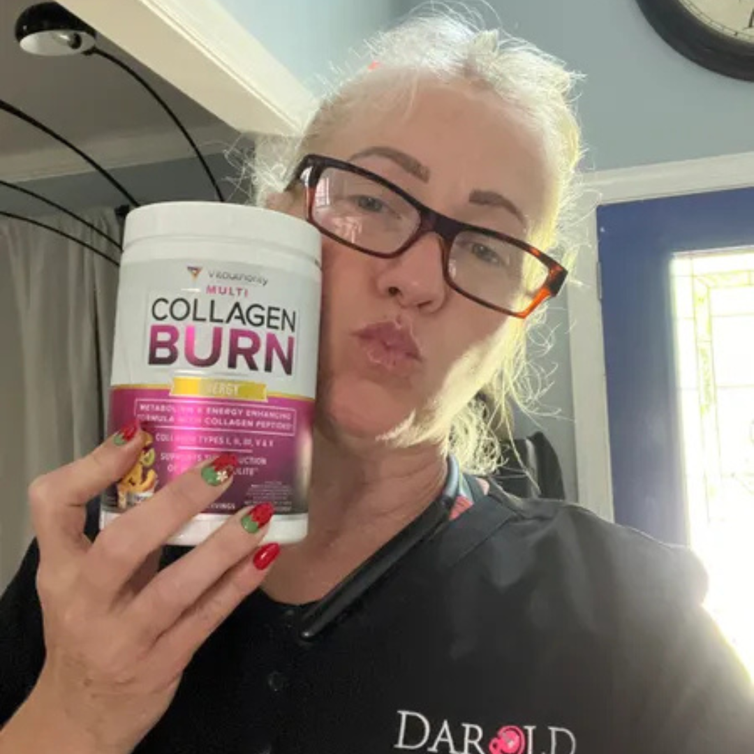 Vitauthority - Vente Supplément oral/vitamine - Poudre Énergétique Multi-Collagène Brûle-Graisse : Punch Tropical, Dimpless7