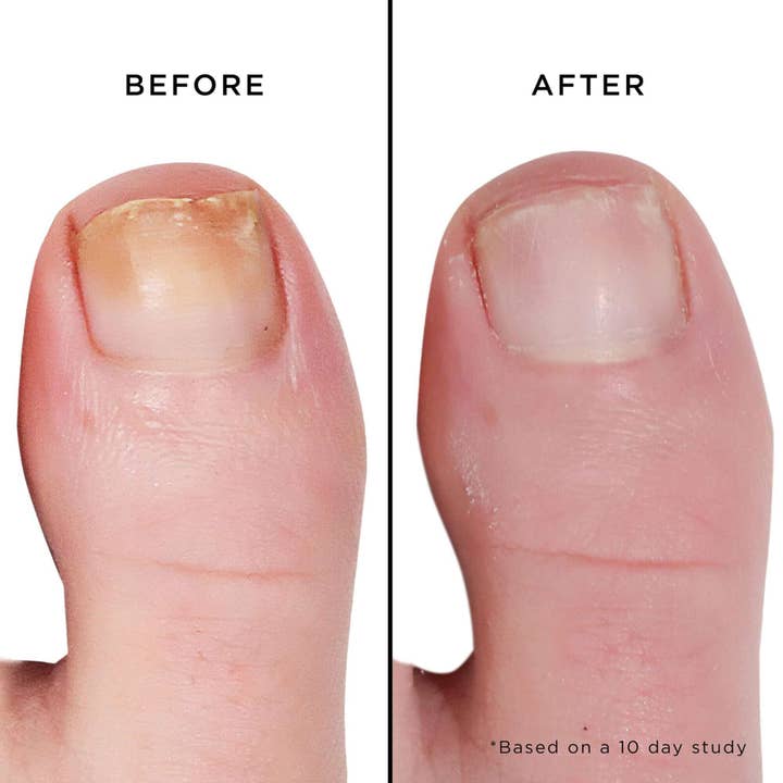 butter LONDON - Wholesale Nail Polish - Mellow The Yellow Nail Brightening Treatment, 0.4 fl oz1