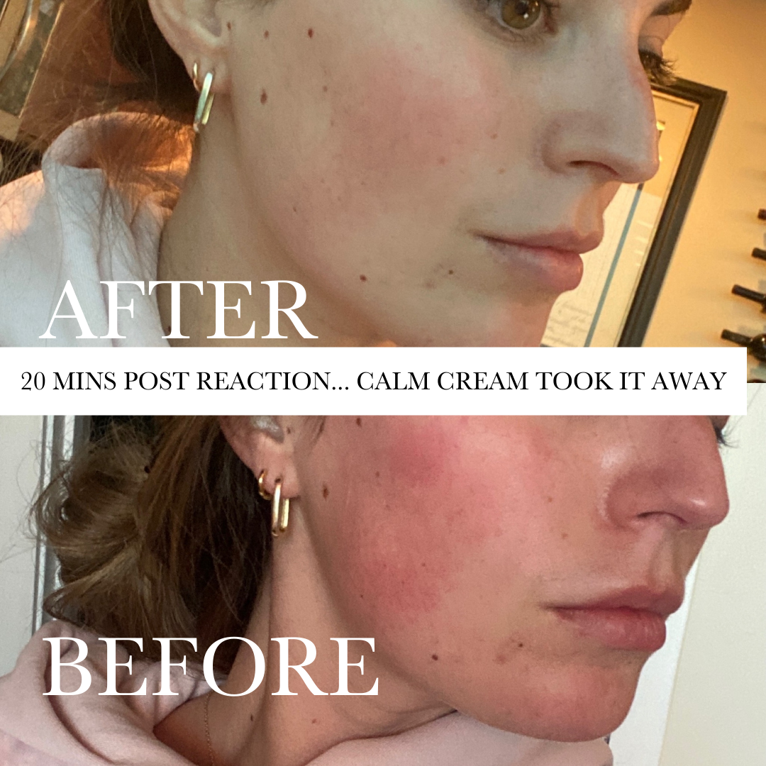 August & Monroe, Inc - Wholesale Facial Moisturizer - Calm Cream (vitamin B3 gel moisturizer)2