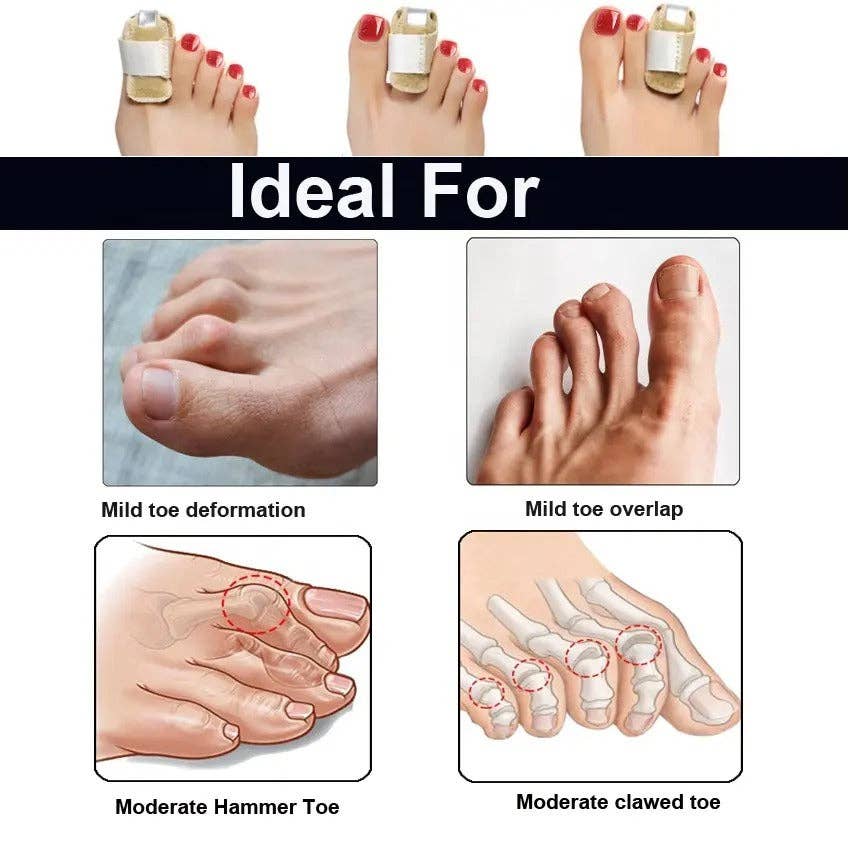 VIGOR - Wholesale Press-On/Fake Nails - Premium Quality Compression Finger Splints with Flexible Bui5