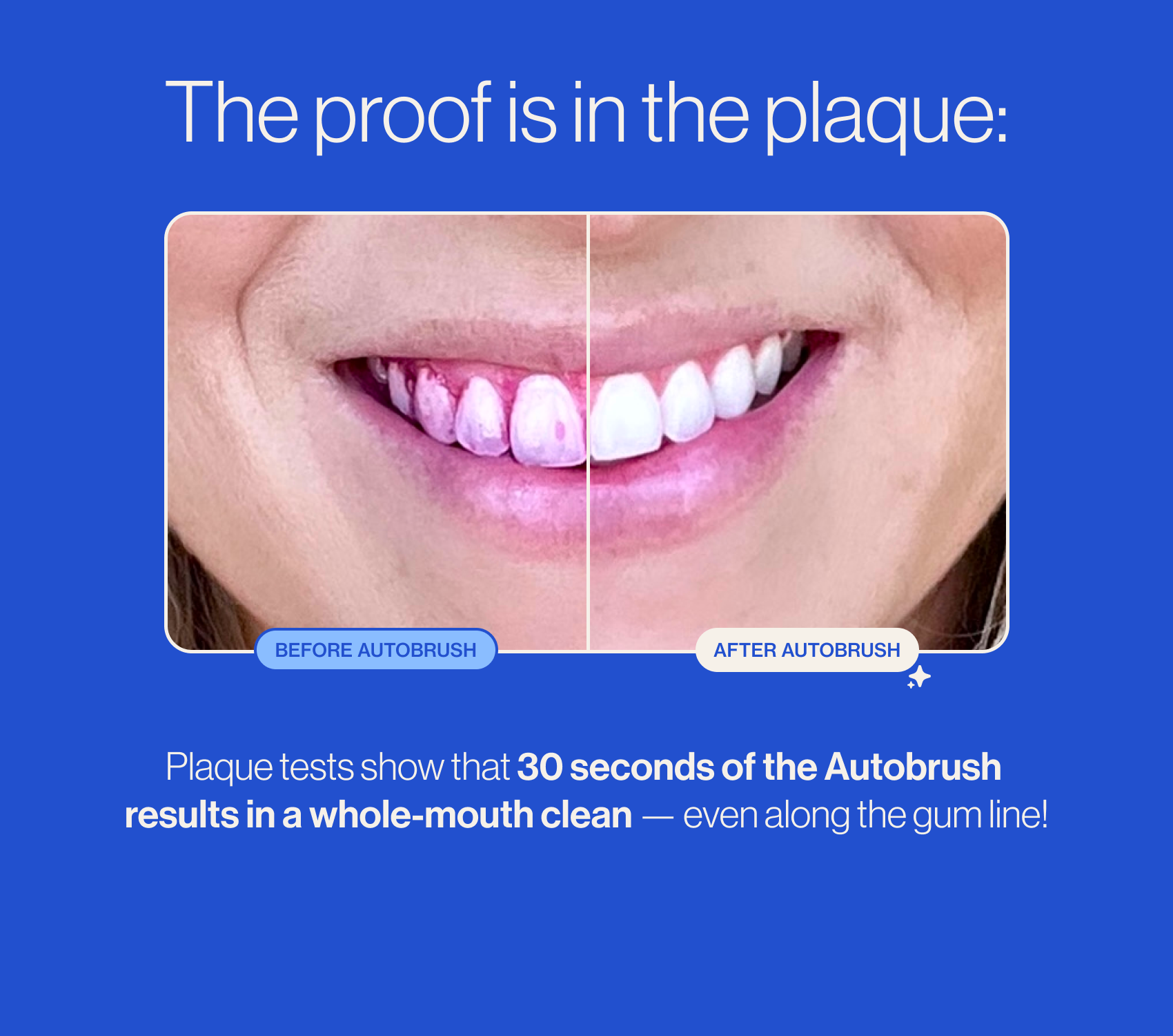 Autobrush® - Vente Brosses à dents - Tête de brosse Autobrush®4