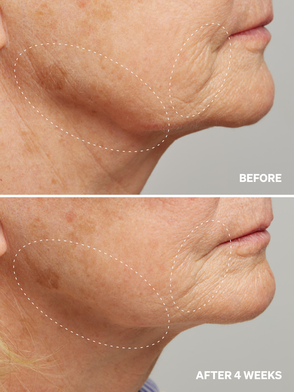 Onélogy – wholesale Facial serum/concentrate – Anti-Aging Serum – Peptides-Cu 0.63