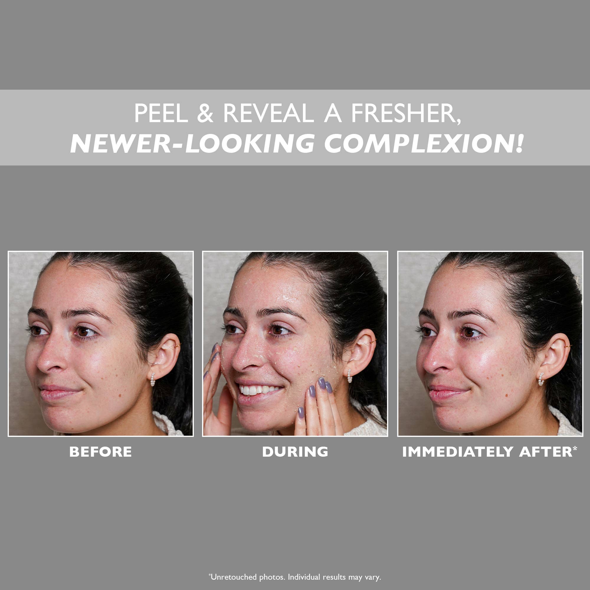 MDV Shop – wholesale Facial peel – Peter Thomas Roth - FIRMx® Peeling Gel 100ml3