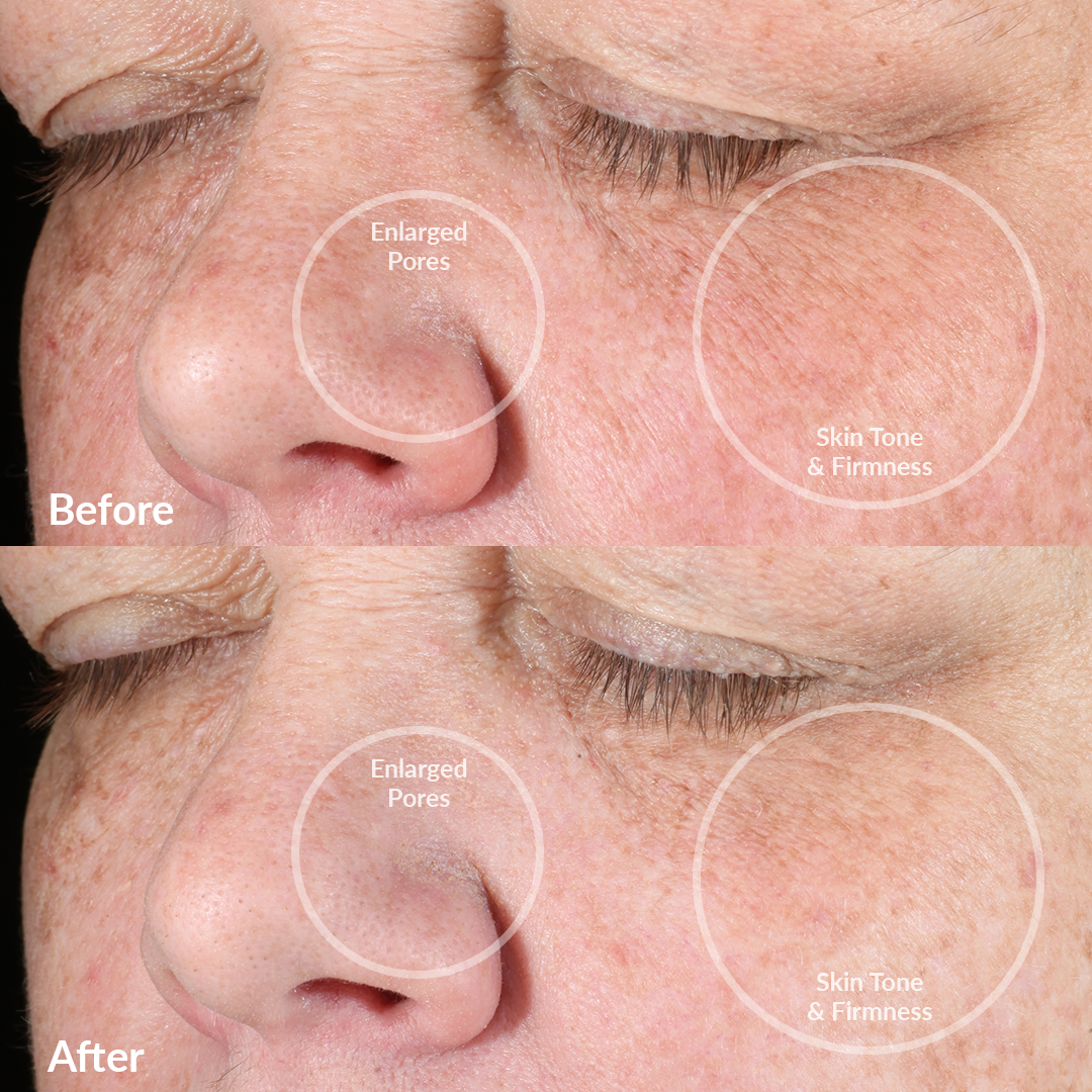 PMD Beauty - US - Wholesale Electronic Skincare Device - PMD Clean Pro Gold3