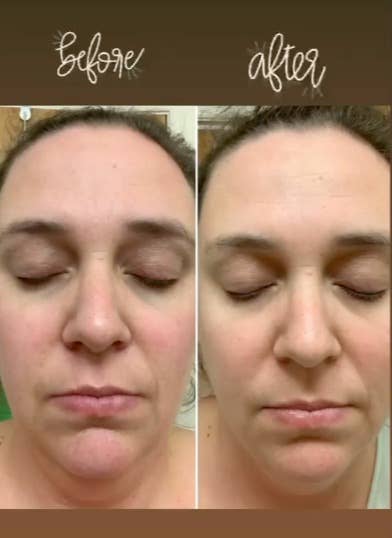 Bella & Bear - Wholesale Gezichtsmasker - Hello Glow gezichtsmasker | Huidverzorging | Gezichtsmasker voor dames1