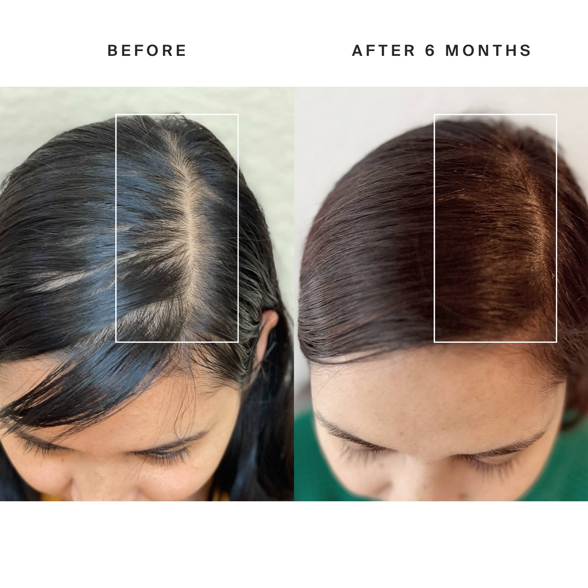 HigherDOSE - Vente Casquette de baseball – unisexe - Chapeau à lumière rouge HigherDose10