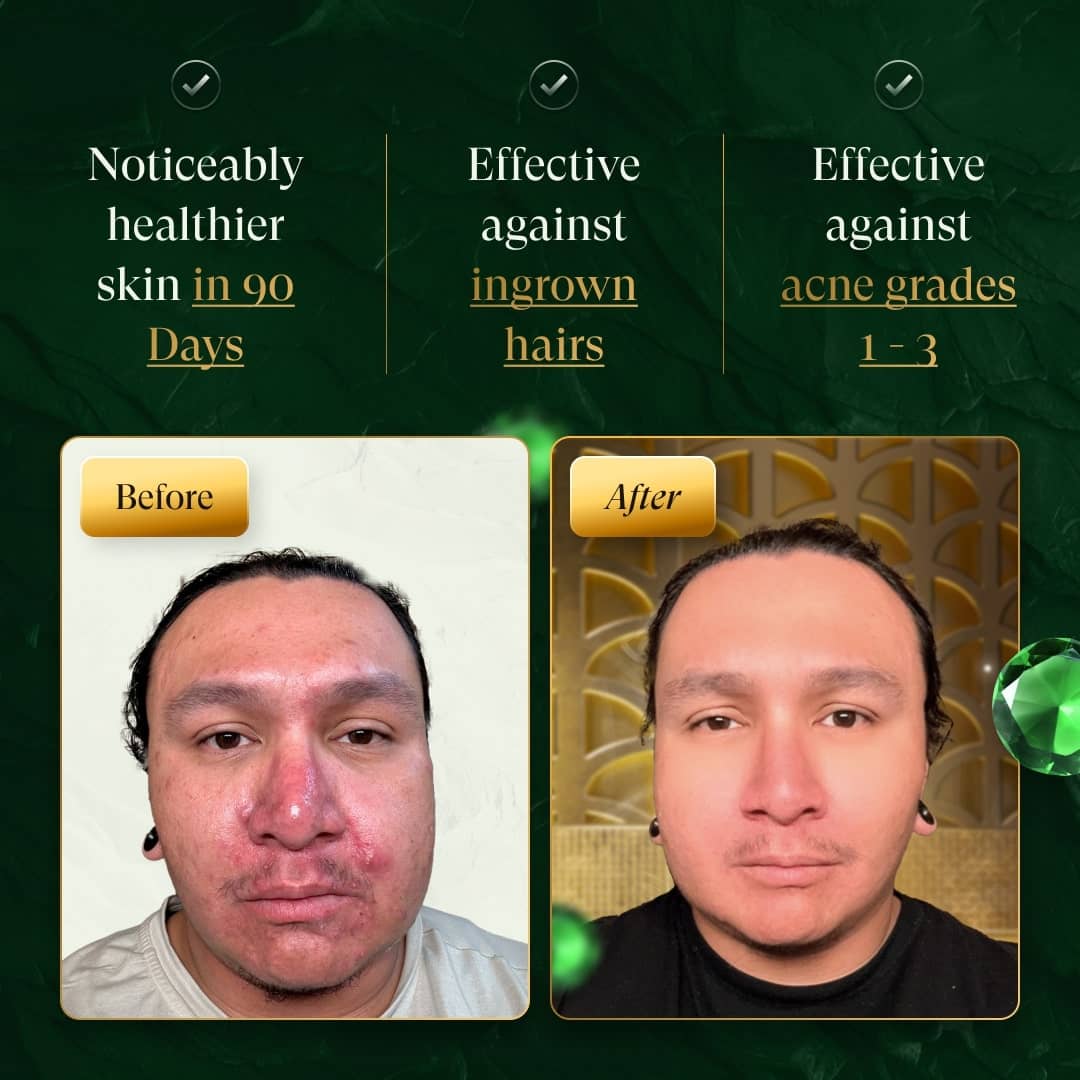 douxds - Wholesale Electronic Skincare Device - FLEX™ Pro Vibrating Face Brush2