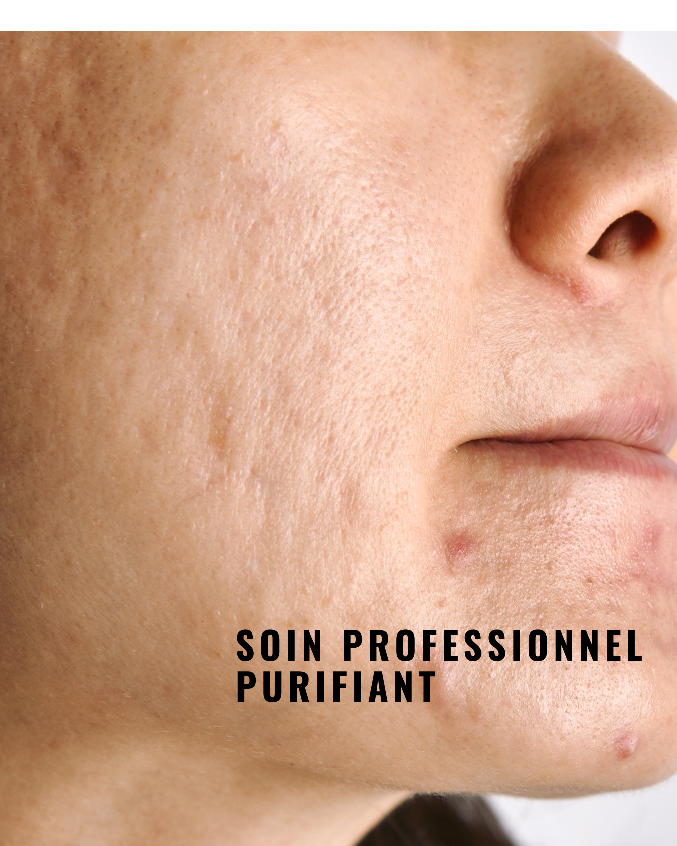 Nadine Salembier - Wholesale Gezichtsmasker - [PRO] Zuiverend Peel-Off Masker - Met actieve kool1