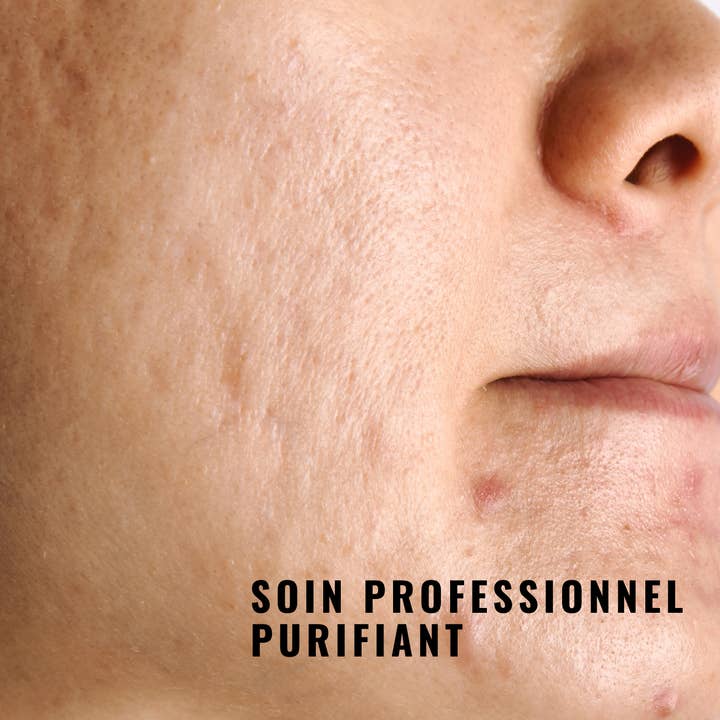 Nadine Salembier – Máscara facial por atacado – Máscara Purificante Peel-Off - Com carvão ativado1