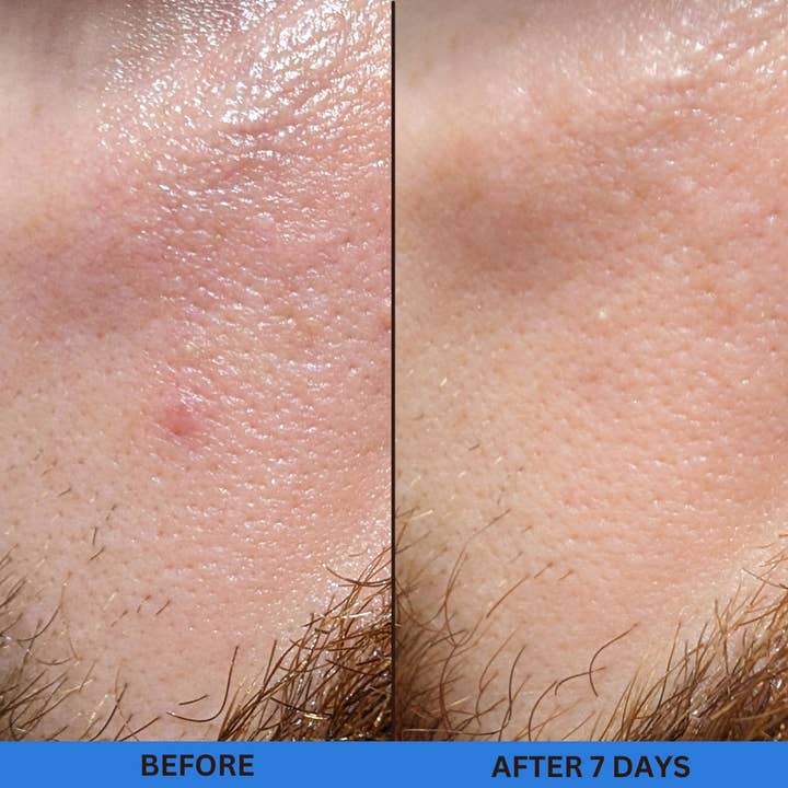 skin magic - Wholesale Facial Toner - 10% Glycolic Treatment Tonic
