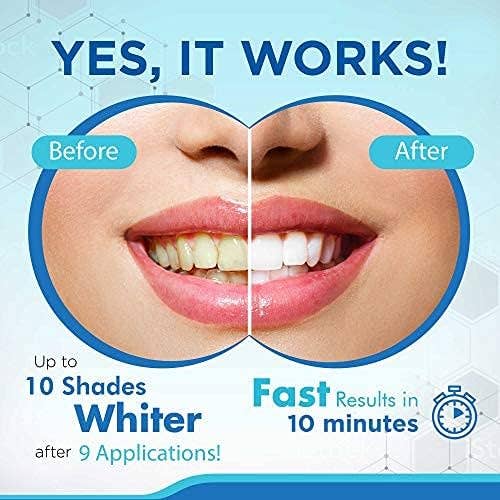 Shine – Großhandel Zahnaufhellung – Spritzen für professionelle Zahnaufhellung, Shine, 3x3ml8