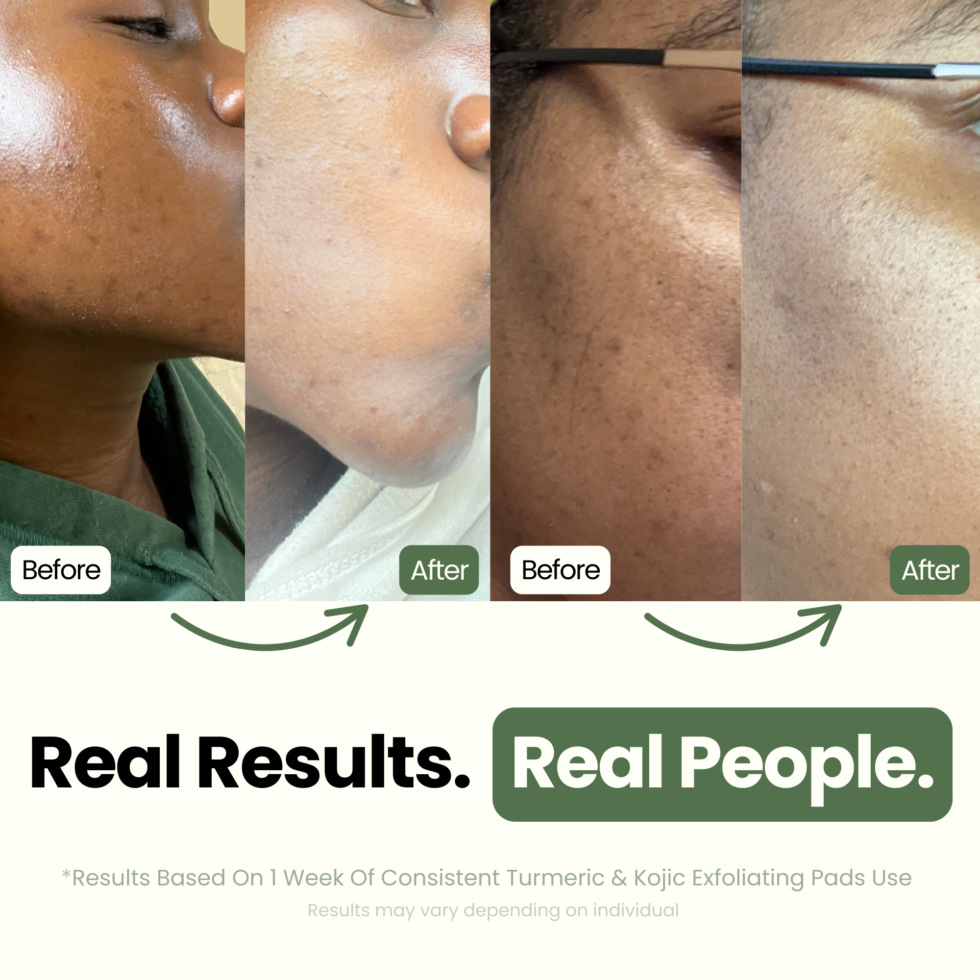 Olahoni Co - Wholesale Facial Cleanser - Wholesale Original Turmeric & Kojic Exfoliating Pads3