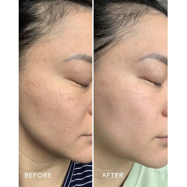 Three Ships (No Duties | Ships from US/CA | USMCA Compliant) - Wholesale Facial Serum/Concentrate - Jelly Drops Kakadu Plum + Mushroom Hyaluronic Acid Serum4