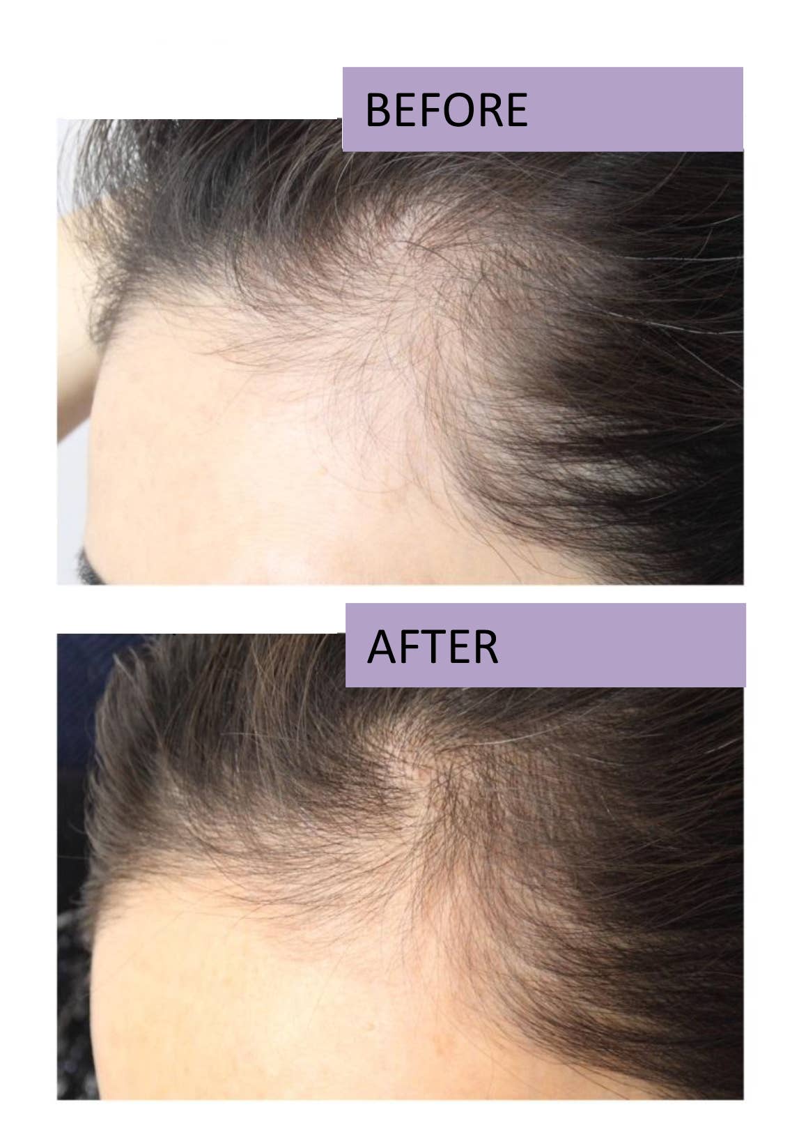 RapidLash - Wholesale Hair Volumizing Product - RapidHair Hair Volumizing Formula4