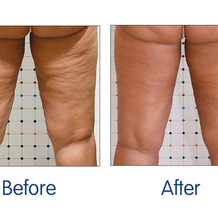 Organic Hair Solution – wholesale Anti-aging moisturiser – CELLULITE & Stretch Marks Treatment-Anti-Aging - Deeply Penetrates Skin to Break Down Fat Tissue- Firms, Tones, Tightens Moisturizes Skin3