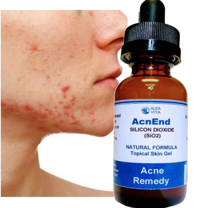 AlkaVita - Wholesale Acne/hydrocolloid patch - Cystic Acne Remedy AcnEnd Gel Silicon Dioxide Fast Results4