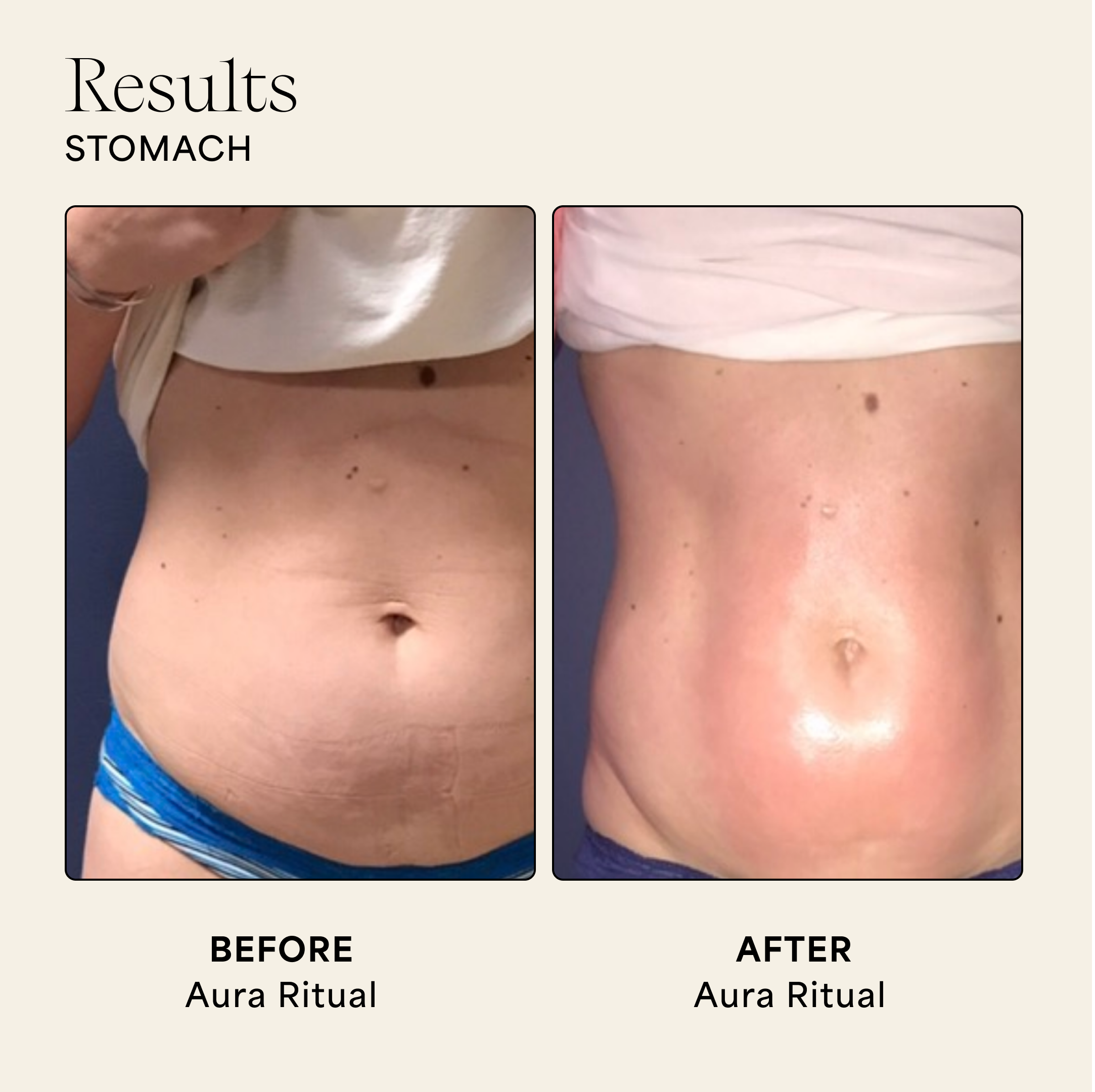 Wildling - Vente Gua Shas - Pierre d'aura2