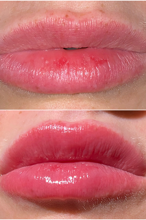 LABËD – wholesale Lip-gloss – LIPJECTION GLOSS1