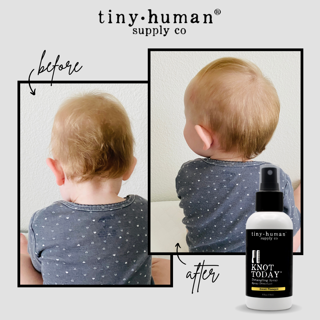 Tiny Human Supply Co. - Wholesale Hair Spray - Knot Today Detangling Spray2