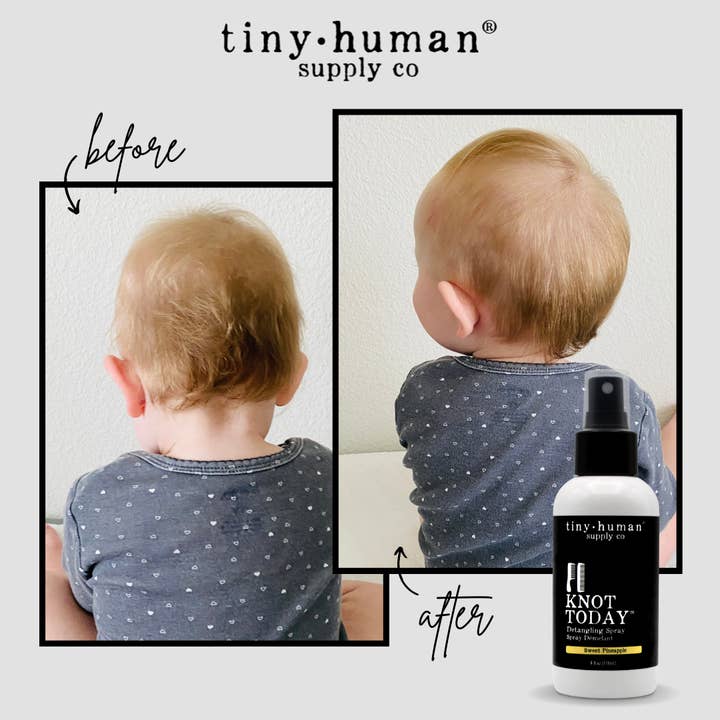 Tiny Human Supply Co. - Vente Laque - Spray démêlant Knot Today2