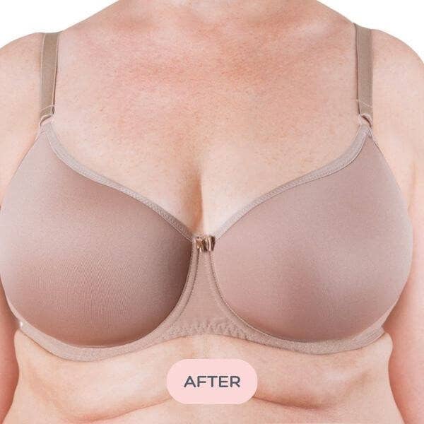 Evenly – wholesale Bra inserts – Women’s – Bra Balancer™ for Asymmetry - Difference of 2-3 Cup Sizes